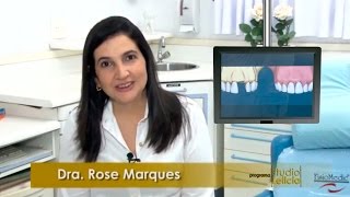 Diferença entre Prótese Fixa e Implante