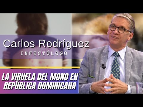 Dr. Carlos Rodríguez, infectólogo, nos orienta sobre la viruela del mono ya circulando en RD