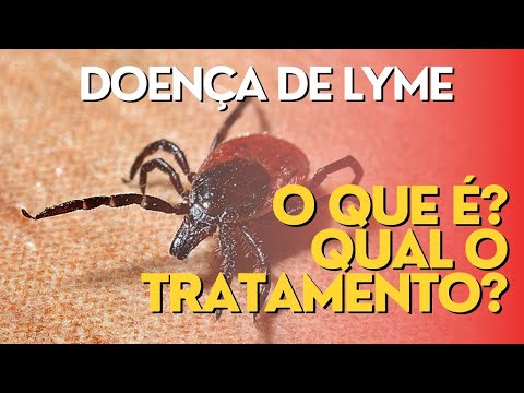 Thumbnail Video Youtube