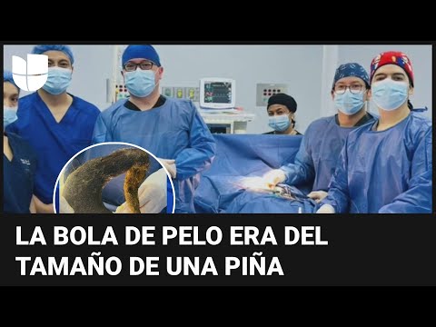 Se quejaba de dolor y hallaron una enorme bola de pelo en su estómago: el Dr. Juan explica qué pasó