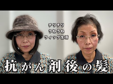 【抗がん剤の脱毛】治療前と髪質が変わった..付き合い方/似合う髪型は？くせ毛を活かした劇的大変身！？