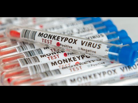 Un centre de vaccination contre la variole du singe ouvre à Paris
