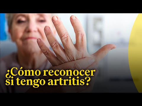 ¿Qué es la artritis y cómo identificarla?