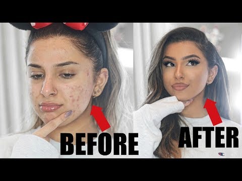 How To FAKE FLAWLESS SKIN!