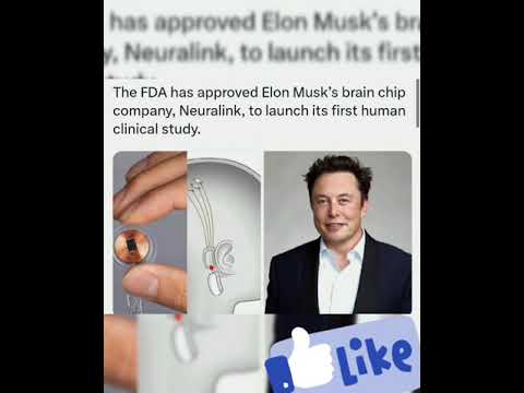 The FDA has approved Elon Musk’s brain chip company, Neuralink, to launch its first human clinic