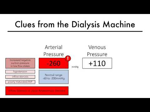 Hemodialysis Access 101 04 Part 2 - Clues from the Dialysis Machine