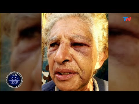 INSEGURIDAD SALVAJE I Una jubilada fue brutalmente asaltada: la golpearon y le robaron todo