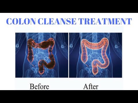 Colon Cleanse Treatment