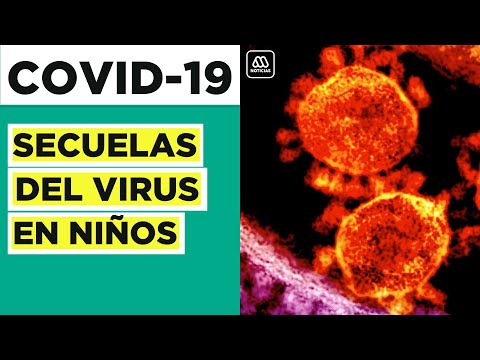Coronavirus | Las secuelas del virus en los niños