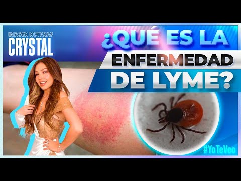 Día Mundial de la Enfermedad de Lyme: ¿Qué es? | Noticias con Crystal Mendivil