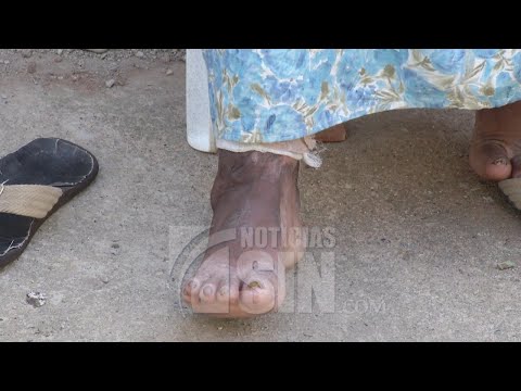 Mujer pide ayuda para tratar dolencia en pierna