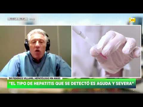 Primer caso de Hepatitis aguda grave en el país - Dr. Federico Villamil | HNT 10