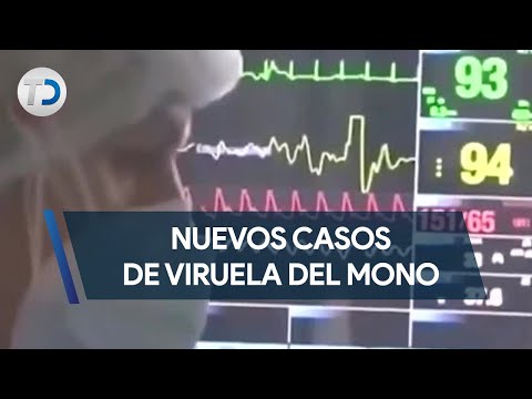 Nuevos casos de viruela del mono en Costa Rica