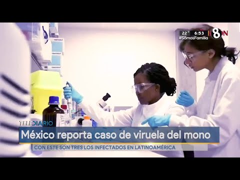 México reporta caso de viruela del mono