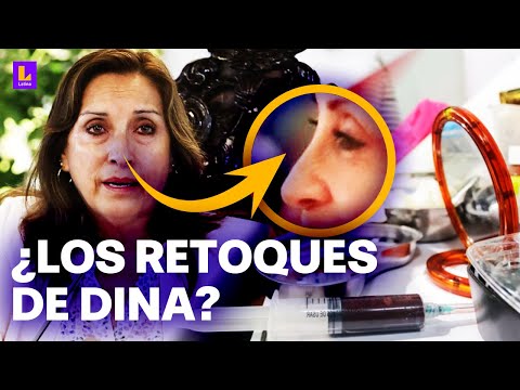 Dina Boluarte y sus retoques estéticos: ¿Quién estuvo a cargo del Perú durante descanso médico?