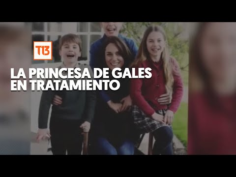 Kate Middleton con cáncer y quimioterapia
