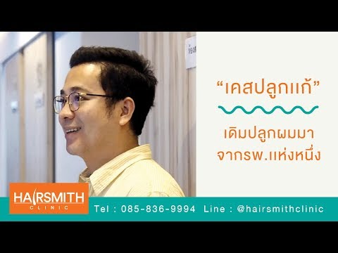 รีวิวแก้งานปลูกผมจากโรงพยาบาลแ รีวิวแก้งานปลูกผมจากโรงพยาบาลแ