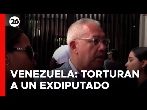 Exdiputado Antichavista detenido y torturado en Venezuela