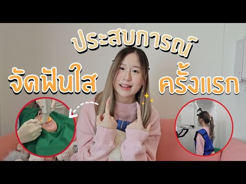 รีวิวเล่าประสบการณ์จัดฟันใสคร