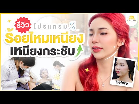 รีวิวร้อยไหมเหนียงกระชับ