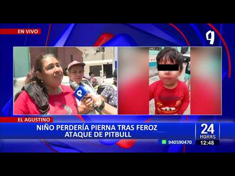 Niño sufre brutal ataque de perro pitbull en El Agustino y podría perder una pierna