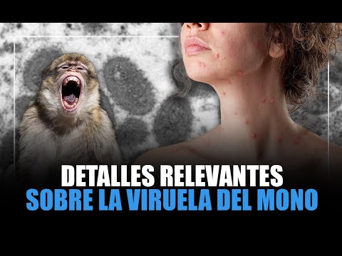 Detalles relevantes sobre la Viruela del Mono