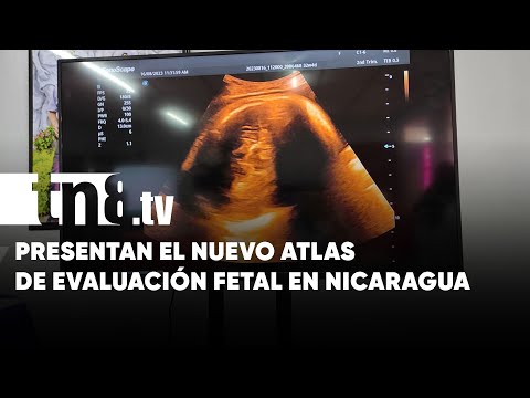 MINSA presenta el nuevo Atlas de Evaluación Fetal en Nicaragua
