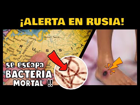 ¡ALERTA! AUTORIDADES SANITARIAS DE RUSIA ALERTAN SOBRE FUGA DE PACIENTES CON BACTERIA MORTAL