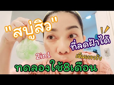 รีวิวสบู่สิวที่ลดฝ้าได้2in1ทดล