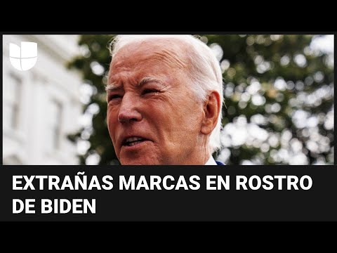 Aclaran por qué el presidente Biden apareció en público con unas extrañas marcas en su rostro