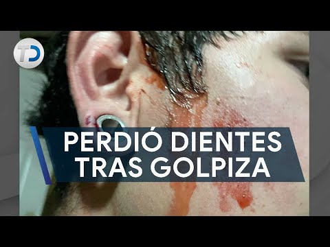 Golpean brutalmente a joven; perdió piezas dentales