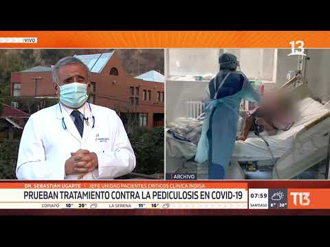 Prueban en Chile tratamiento contra la pediculosis para pacientes COVID-19