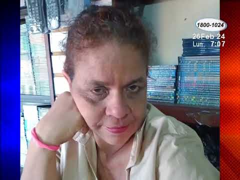 Señora de 50 años fue atropellada por motocicleta en Managua