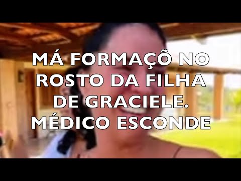 MÁ FORMAÇÃO DO ROSTO DA FILHA DE GRACIELE