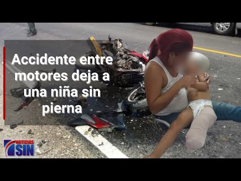 Accidente entre motores deja a una niña sin pierna