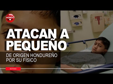 ADOLESCENTE LATINO HUYE DE SU CASA Y PIERDE LA VIDA