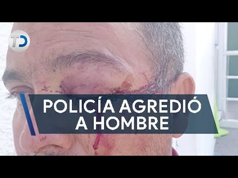 Hombre denuncia a policía; lo agredió brutalmente