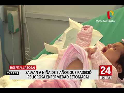 Hospital Sabogal: salvan a niña de 2 años que padeció enfermedad estomacal
