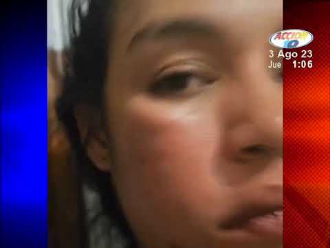 Joven nicaraguense residente en España fue agredida físicamente por su pareja