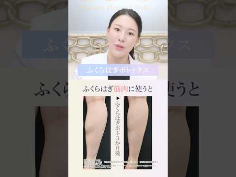 【脚痩せ】モリっと筋肉はボトックスで細くなれます【美脚ダイエット】湘南美容クリニック西川礼華@SBCofficial @10yearsback