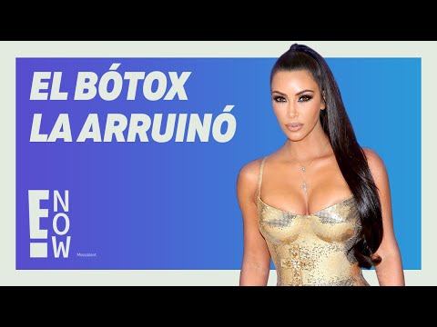 KIM KARDASHIAN REVELA CÓMO EL BÓTOX HA IMPACTADO SU CARRERA COMO ACTRIZ