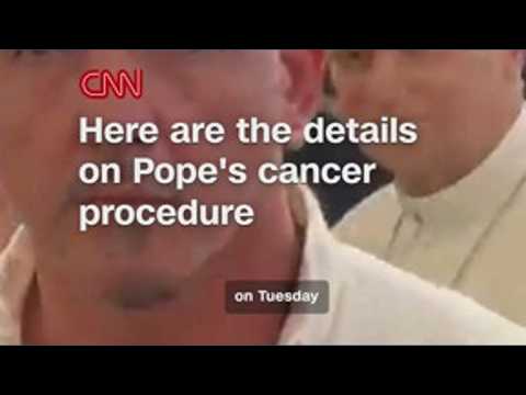 Details of Pope Leo's <strong>cancer</strong> procedure