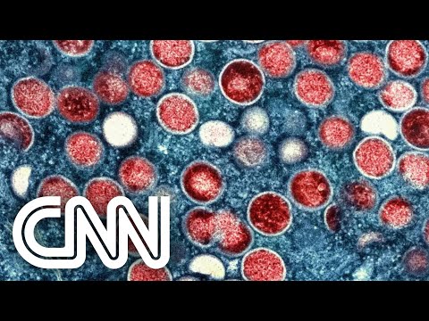 OMS estuda mudar nomenclatura da varíola dos macacos | CNN PRIME TIME