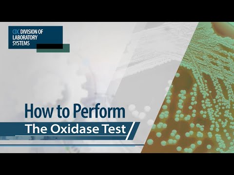 How to Perform the Oxidase Test