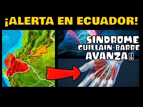 ¡ALERTA! AUTORIDADES SANITARIAS DE ECUADOR ALERTAN INCREMENTO DE CASOS DE GUILLAIN_BARRÉ