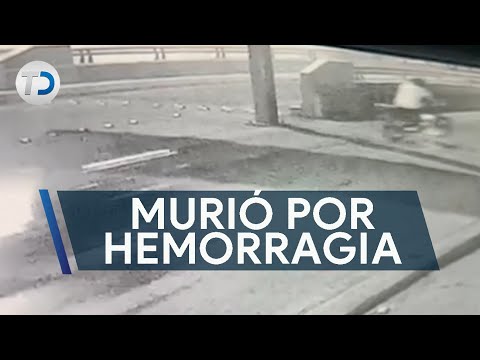 Joven murió por hemorragia cerebral; buscan al motociclista que lo impactó