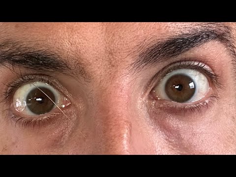 Jesse Wellens is live!