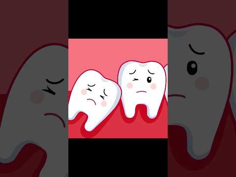ASMR Wisdom tooth animation P1 #asmr #animation #roblox #trending #shorts