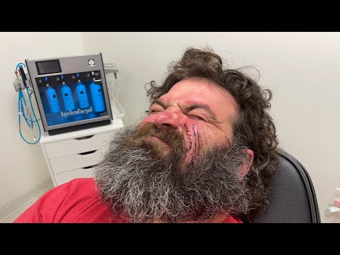 Live!!! Bubba assisting dr Diaco on lummys dog bite