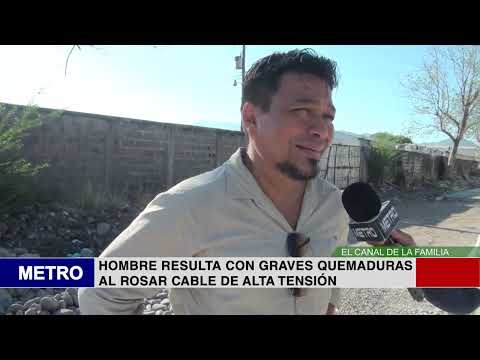 HOMBRE RESULTA CON GRAVES QUEMADURAS AL ROSAR CABLE DE ALTA TENSIÓN